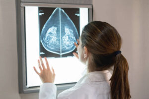 Read more about the article Advanced cancer treatment Tijuana